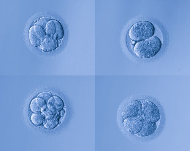 体外培养—胚胎移植