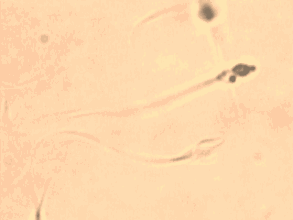 你知道精子在显微镜下是什么样子吗？